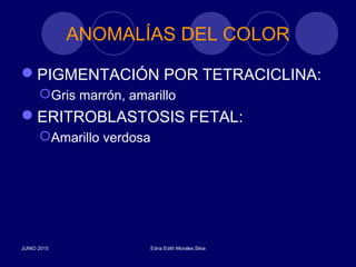 ANOMALÍAS DEL COLOR
PIGMENTACIÓN POR TETRACICLINA:
Gris marrón, amarillo
ERITROBLASTOSIS FETAL:
Amarillo verdosa
JUNIO 2015 Edna Edith Morales Silva
 