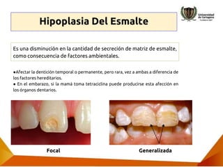Anomalias De Estructura (anomalías dentales) | PPTX