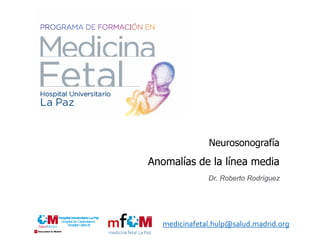 Neurosonografía
Anomalías de la línea media
Dr. Roberto Rodríguez
medicinafetal.hulp@salud.madrid.org
 