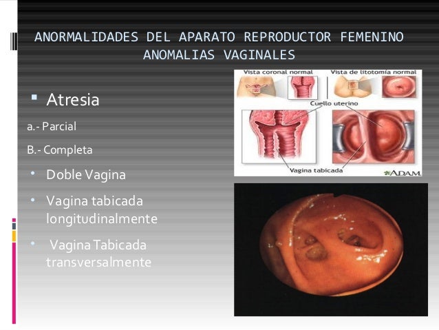 Anomalias del aparato reproductor femenino, por dr. andrés ortega