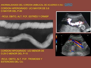 ANORMALIDADES DEL CORDON UMBILICAL DE ACUERDO A SU : GIRO
CORDON HIPERGIRADO UCI MAYOR DE 0.6
O MAYOR DEL P-90
- RCUI, OBITO, ALT. FCF, ESTRÉS Y CRMSP
CORDON HIPOGIRADO UCI MENOR DE
O.29 O MENOR DEL P-10
-RCUI, OBITO, ALT. FCF, TROMOSIS Y
ESTENOSIS DEL CU.
 