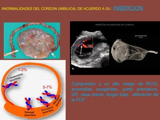 ANORMALIDADES DEL CORDON UMBILICAL DE ACUERDO A SU : INSERCION
5-7%
1-2%
Compresión y un alto riesgo de RCIU,
anomalías congénitas, parto prematuro,
DP, vasa previa, Apgar bajo, alteración de
la FCF.
 