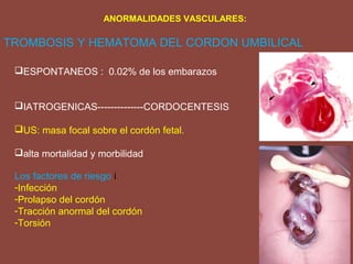 ANORMALIDADES VASCULARES:
TROMBOSIS Y HEMATOMA DEL CORDON UMBILICAL
ESPONTANEOS : 0.02% de los embarazos
IATROGENICAS--------------CORDOCENTESIS
US: masa focal sobre el cordón fetal.
alta mortalidad y morbilidad
Los factores de riesgo i
-Infección
-Prolapso del cordón
-Tracción anormal del cordón
-Torsión
 