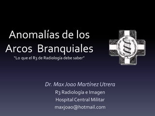 Anomalías de los
Arcos Branquiales
“Lo que el R3 de Radiología debe saber”
Dr. MaxJoao Martínez Utrera
R3 Radiología e Imagen
Hospital Central Militar
maxjoao@hotmail.com
 