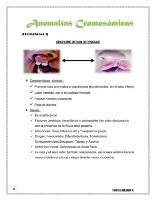 VANESSA MIRANDA M.1
(CROMOSOMA 1)
SÍNDROME DE VAN DER WOUDE
 Características clínicas :
 Prominencias anormales o depresiones (hundimientos) en el labio inferior
 Labio hendido, con o sin paladar hendido
 Paladar hendido solamente
 Falta de dientes
 Causa :
 Es multifactorial.
 Factores genéticos, hereditarios y ambientales han sido relacionados
con la presencia de la fisura labio palatina.
 Infecciones: Virus Influenza A2 y Toxoplasma gondii.
 Drogas: Fenobarbital, Difenilhidantoina, Trimetadiona
Corticoesteroides,Diazepam, Tabaco y Alcohol.
 Déficit nutricional: Deficiencias de ácido fólico.
 La raza y el sexo están también relacionados, así la raza asiática tiene la
mayor incidencia y la raza negra tiene la menor incidencia.
 