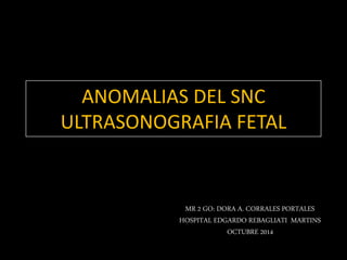 ANOMALIAS DEL SNC 
ULTRASONOGRAFIA FETAL 
MR 2 GO: DORA A. CORRALES PORTALES 
HOSPITAL EDGARDO REBAGLIATI MARTINS 
OCTUBRE 2014 
 