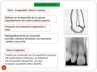 Anomalías de forma
Dens invaginatión (Dens in dente).
Defecto en el desarrollo de la corona,
especialmente del incisivo lateral superior.
Presenta una pequeña invaginación o
fosa.
Radiográficamente se encuentra
esmalte y dentina formando una estructura
similar a una cinta
Tubérculo anómalo en la superficie oclusal
de premolares inferiores, es bilateral.
No se puede desgastar, ya que
la pulpa quedaría descubierta.
Dens evaginatus.
10
 
