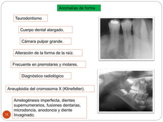 Anomalías de forma
Taurodontismo
Diagnóstico radiológico
Amelogénesis imperfecta, dientes
supernumerarios, fusiones dentarias,
microdoncia, anodoncia y diente
Invaginado.
Aneuploidia del cromosoma X (Klinefelter).
11
Cuerpo dental alargado.
Cámara pulpar grande.
Alteración de la forma de la raíz.
Frecuente en premolares y molares.
 
