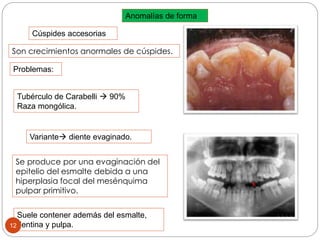 Anomalías de forma
Son crecimientos anormales de cúspides.
Cúspides accesorias
Problemas:
Tubérculo de Carabelli  90%
Raza mongólica.
Se produce por una evaginación del
epitelio del esmalte debida a una
hiperplasia focal del mesénquima
pulpar primitivo.
Variante diente evaginado.
Suele contener además del esmalte,
dentina y pulpa.12
 