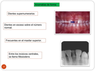 Anomalías de forma
Dientes supernumerarios
Dientes en exceso sobre el número
normal.
Frecuentes en el maxilar superior.
Entre los incisivos centrales,
se llama Mesiodens
17
 