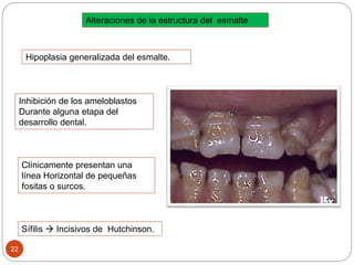 Hipoplasia generalizada del esmalte.
Inhibición de los ameloblastos
Durante alguna etapa del
desarrollo dental.
Sífilis  Incisivos de Hutchinson.
Alteraciones de la estructura del esmalte
Clínicamente presentan una
línea Horizontal de pequeñas
fositas o surcos.
22
 