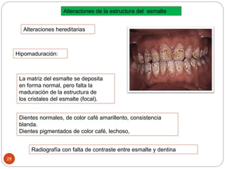 Hipomaduración:
Alteraciones de la estructura del esmalte
Alteraciones hereditarias
La matriz del esmalte se deposita
en forma normal, pero falta la
maduración de la estructura de
los cristales del esmalte (focal).
Dientes normales, de color café amarillento, consistencia
blanda.
Dientes pigmentados de color café, lechoso,
Radiografía con falta de contraste entre esmalte y dentina
28
 