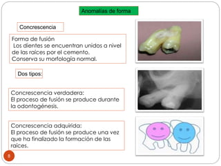 Anomalías de forma
Forma de fusión
Los dientes se encuentran unidos a nivel
de las raíces por el cemento.
Conserva su morfología normal.
Concrescencia
Concrescencia verdadera:
El proceso de fusión se produce durante
la odontogénesis.
Concrescencia adquirida:
El proceso de fusión se produce una vez
que ha finalizado la formación de las
raíces.
Dos tipos:
8
 
