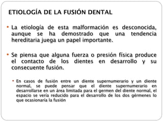 ETIOLOGÍA DE LA FUSIÓN DENTAL

 La etiología de esta malformación es desconocida,
 aunque se ha demostrado que una                            tendencia
 hereditaria juega un papel importante.

 Se piensa que alguna fuerza o presión física produce
 el contacto de los dientes en desarrollo y su
 consecuente fusión.

   En casos de fusión entre un diente supernumerario y un diente
   normal, se puede pensar que el diente supernumerario en
   desarrollarse en un área limitada para el germen del diente normal, el
   espacio se vería reducido para el desarrollo de los dos gérmenes lo
   que ocasionaría la fusión
 