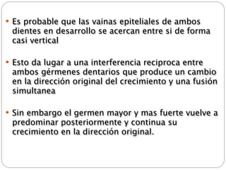  Es probable que las vainas epiteliales de ambos
 dientes en desarrollo se acercan entre si de forma
 casi vertical

 Esto da lugar a una interferencia reciproca entre
 ambos gérmenes dentarios que produce un cambio
 en la dirección original del crecimiento y una fusión
 simultanea

 Sin embargo el germen mayor y mas fuerte vuelve a
 predominar posteriormente y continua su
 crecimiento en la dirección original.
 