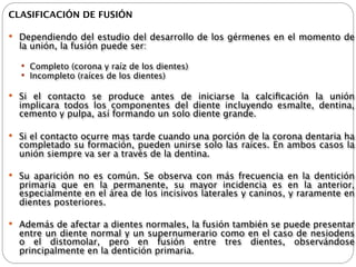 CLASIFICACIÓN DE FUSIÓN

 Dependiendo del estudio del desarrollo de los gérmenes en el momento de
  la unión, la fusión puede ser:

   Completo (corona y raíz de los dientes)
   Incompleto (raíces de los dientes)

 Si el contacto se produce antes de iniciarse la calciﬁcación la unión
  implicara todos los componentes del diente incluyendo esmalte, dentina,
  cemento y pulpa, así formando un solo diente grande.

 Si el contacto ocurre mas tarde cuando una porción de la corona dentaria ha
  completado su formación, pueden unirse solo las raíces. En ambos casos la
  unión siempre va ser a través de la dentina.

 Su aparición no es común. Se observa con más frecuencia en la dentición
  primaria que en la permanente, su mayor incidencia es en la anterior,
  especialmente en el área de los incisivos laterales y caninos, y raramente en
  dientes posteriores.

 Además de afectar a dientes normales, la fusión también se puede presentar
  entre un diente normal y un supernumerario como en el caso de nesiodens
  o el distomolar, pero en fusión entre tres dientes, observándose
  principalmente en la dentición primaria.
 