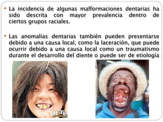  La incidencia de algunas malformaciones dentarias ha
 sido descrita con   mayor   prevalencia      dentro   de
 ciertos grupos raciales.

 Las anomalías dentarias también pueden presentarse
 debido a una causa local, como la laceración, que puede
 ocurrir debido a una causa local como un traumatismo
 durante el desarrollo del diente o puede ser de etiología
 