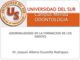 UNIVERSIDAD DEL SUR
              Campus Mérida
              ODONTOLOGIA

ANORMALIDADES EN LA FORMACION DE LOS
              DIENTES




 Dr. Joaquín Alberto Escamilla Rodríguez
 