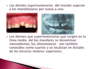  Los dientes supernumerarios del maxilar superan
a los mandibulares por nueve a uno.
 Los dientes que supernumerarios que surgen en la
línea media del los maxilares se denominan
mesiodientes, los distomolares son también
conocidos como cuartos y se localizan en distales
de los terceros molares superiores.
 