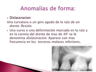  Dislaceracion:
Una curvatura o un giro agudo de la raíz de un
diente flexión.
 Una curva o una deformación marcada en la raíz y
en la corona del diente de mas de 40° se le
denomina dislaceracion. Aparece con mas
frecuencia en los terceros molares inferiores.
 