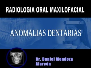 Dr. Daniel Mendoza Alarcón RADIOLOGIA ORAL MAXILOFACIAL ANOMALIAS DENTARIAS 