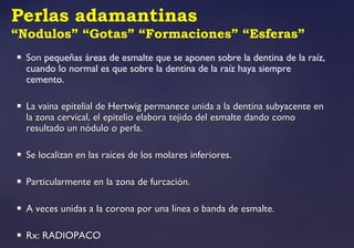 Perlas adamantinas
“Nodulos” “Gotas” “Formaciones” “Esferas”
 SonSon pequeñas áreas de esmalte que se aponen sobre la dentina de la raíz,
cuando lo normal es que sobre la dentina de la raíz haya siempre
cemento.
 La vaina epitelial de Hertwig permanece unida a la dentina subyacente enLa vaina epitelial de Hertwig permanece unida a la dentina subyacente en
la zona cervical, el epitelio elabora tejido del esmalte dando comola zona cervical, el epitelio elabora tejido del esmalte dando como
resultado un nódulo o perla.resultado un nódulo o perla.
 Se localizan en las raíces de los molares inferiores.Se localizan en las raíces de los molares inferiores.
 Particularmente en la zona de furcación.Particularmente en la zona de furcación.
 A veces unidas a la corona por una línea o banda de esmalte.A veces unidas a la corona por una línea o banda de esmalte.
 Rx: RADIOPACORx: RADIOPACO
 