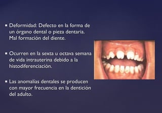  Deformidad: Defecto en la forma deDeformidad: Defecto en la forma de
un órgano dental o pieza dentaria.un órgano dental o pieza dentaria.
Mal formación del diente.Mal formación del diente.
 Ocurren en la sexta u octava semanaOcurren en la sexta u octava semana
de vida intrauterina debido a lade vida intrauterina debido a la
histodiferenciación.histodiferenciación.
 Las anomalías dentales se producenLas anomalías dentales se producen
con mayor frecuencia en la denticióncon mayor frecuencia en la dentición
del adulto.del adulto.
 