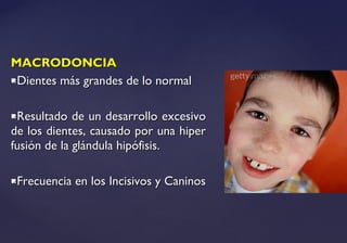 MACRODONCIAMACRODONCIA
Dientes más grandes de lo normalDientes más grandes de lo normal
Resultado de un desarrollo excesivoResultado de un desarrollo excesivo
de los dientes, causado por una hiperde los dientes, causado por una hiper
fusión de la glándula hipófisis.fusión de la glándula hipófisis.
Frecuencia en los Incisivos y CaninosFrecuencia en los Incisivos y Caninos
 