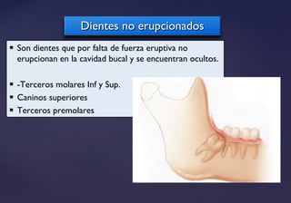  Son dientes que por falta de fuerza eruptiva no
erupcionan en la cavidad bucal y se encuentran ocultos.
 -Terceros molares Inf y Sup.
 Caninos superiores
 Terceros premolares
Dientes no erupcionadosDientes no erupcionados
 
