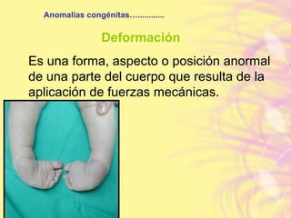 Anomalías congénitas…............
Deformación
Es una forma, aspecto o posición anormal
de una parte del cuerpo que resulta de la
aplicación de fuerzas mecánicas.
 