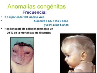 Anomalías congénitas
Frecuencia:
• 2 a 3 por cada 100 nacido vivo
• Aumenta a 6% a los 2 años
y a 8% a los 5 años
• Responsable de aproximadamente un
20 % de la mortalidad de lactantes
 