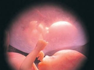 Objetivo general:
Explicar el origen, mecanismo de
producción y frecuencia de las
alteraciones del desarrollo ontogenético del
ser humano.
•Objetivos específicos
 