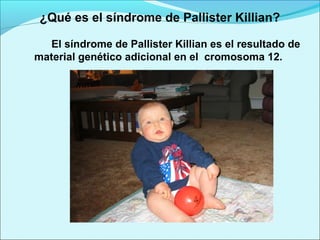 ¿Qué es el síndrome de Pallister Killian?
El síndrome de Pallister Killian es el resultado de
material genético adicional en el cromosoma 12.
 