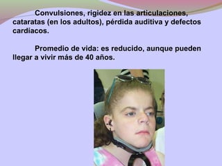 Convulsiones, rigidez en las articulaciones,
cataratas (en los adultos), pérdida auditiva y defectos
cardíacos.
Promedio de vida: es reducido, aunque pueden
llegar a vivir más de 40 años.
 