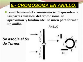  Los extremos del cromosoma se desprenden y
las partes distales del cromosoma se
aproximan y finalmente se unen para formar
un anillo.
Se asocia al Sx
de Turner.
6.- CROMOSOMA EN ANILLO.
 