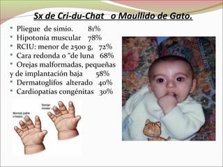 Sx de Cri-du-Chat o Maullido de Gato.
 Pliegue de simio. 81%
 Hipotonía muscular 78%
 RCIU: menor de 2500 g, 72%
 Cara redonda o “de luna 68%
 Orejas malformadas, pequeñas
y de implantación baja 58%
 Dermatoglifos alterado 40%
 Cardiopatías congénitas 30%
 