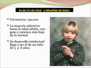 Sx de Cri-du-Chat o Maullido de Gato.
 Frecuencia: 1:50,000
 La mayoría sobrevive
hasta la edad adulta, con
peso y estatura más baja
de lo normal
 Su desarrollo intelectual
llega a ser el de un niño
de 5 a 6 años
 