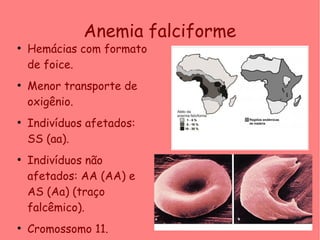 Anemia falciforme
●
Hemácias com formato
de foice.
●
Menor transporte de
oxigênio.
●
Indivíduos afetados:
SS (aa).
●
Indivíduos não
afetados: AA (AA) e
AS (Aa) (traço
falcêmico).
●
Cromossomo 11.
 