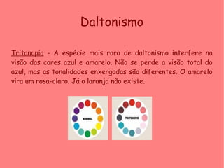 Tritanopia - A espécie mais rara de daltonismo interfere na
visão das cores azul e amarelo. Não se perde a visão total do
azul, mas as tonalidades enxergadas são diferentes. O amarelo
vira um rosa-claro. Já o laranja não existe.
Daltonismo
 
