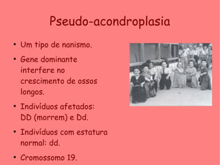 Pseudo-acondroplasia
●
Um tipo de nanismo.
●
Gene dominante
interfere no
crescimento de ossos
longos.
●
Indivíduos afetados:
DD (morrem) e Dd.
●
Indivíduos com estatura
normal: dd.
●
Cromossomo 19.
 