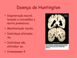 Doença de Huntington
●
Degeneração neural,
levando a convulsões e
morte prematura;
●
Manifestação tardia;
●
Indivíduos afetados:
Aa.
●
Indivíduos não
afetados: aa.
●
Cromossomo 4.
 