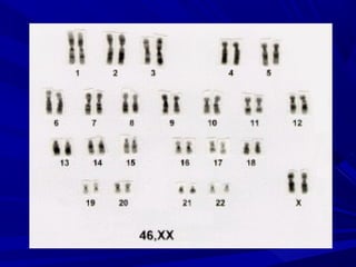 Anomalias genéticas na espécie humana