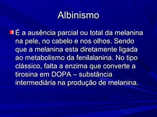 Albinismo
É a ausência parcial ou total da melanina
na pele, no cabelo e nos olhos. Sendo
que a melanina esta diretamente ligada
ao metabolismo da fenilalanina. No tipo
clássico, falta a enzima que converte a
tirosina em DOPA – substância
intermediária na produção de melanina.
 