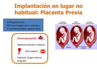 Implantación en lugar no
habitual: Placenta Previa
1/200 gestaciones
20% hemorragias tercer trimestre
↑ morbimortalidad materno fetal
Hemorragia genital
Abdomen blando e indoloro
Tacto vaginal
Espéculo: Origen interno
Ecografía
 