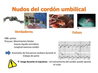 Nudos del cordón umbilical
FalsosVerdaderos
1% partos
Causas: Movimientos fetales
Exceso líquido amniótico
Longitud excesiva cordón
Anomalías de frecuencia cardiaca durante el
trabajo de parto
↑ riesgo durante el expulsivo el estiramiento del cordón puede apretar
el nudo
 