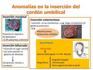 Anomalías en la inserción del
cordón umbilical
Inserción velamentosa
•Inserción en las membranas Llega a la placenta sin
gelatina protectora
•1 %
Placenta previa
Gestaciones múltiples
Vasa Praevia
Hemorragia
Anemia fetal aguda Muerte
Ecografía Doppler
Diagnóstico Amnioscopia
Tacto vaginal durante el parto
Inserción marginal
Placenta en raqueta o
de Battledore
•2-6% placentas a término
Inserción bifurcada
•Inserción en lugar normal
•Los vasos pierden la
gelatina de Wharton
Compresión, torsión y
trombosis
 
