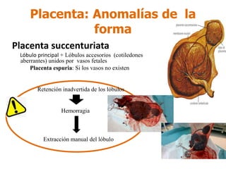 Placenta succenturiata
Lóbulo principal + Lóbulos accesorios (cotiledones
aberrantes) unidos por vasos fetales
Placenta espuria: Si los vasos no existen
Retención inadvertida de los lóbulos
Hemorragia
Extracción manual del lóbulo
Placenta: Anomalías de la
forma
 