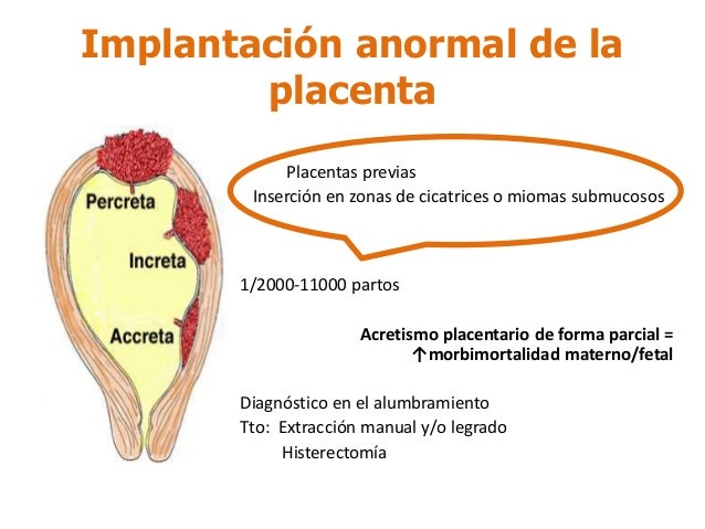 Anomalias placentarias