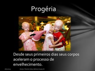 Progéria
Desde seus primeiros dias seus corpos
aceleram o processo de
envelhecimento.