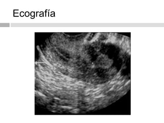Ecografía
 
